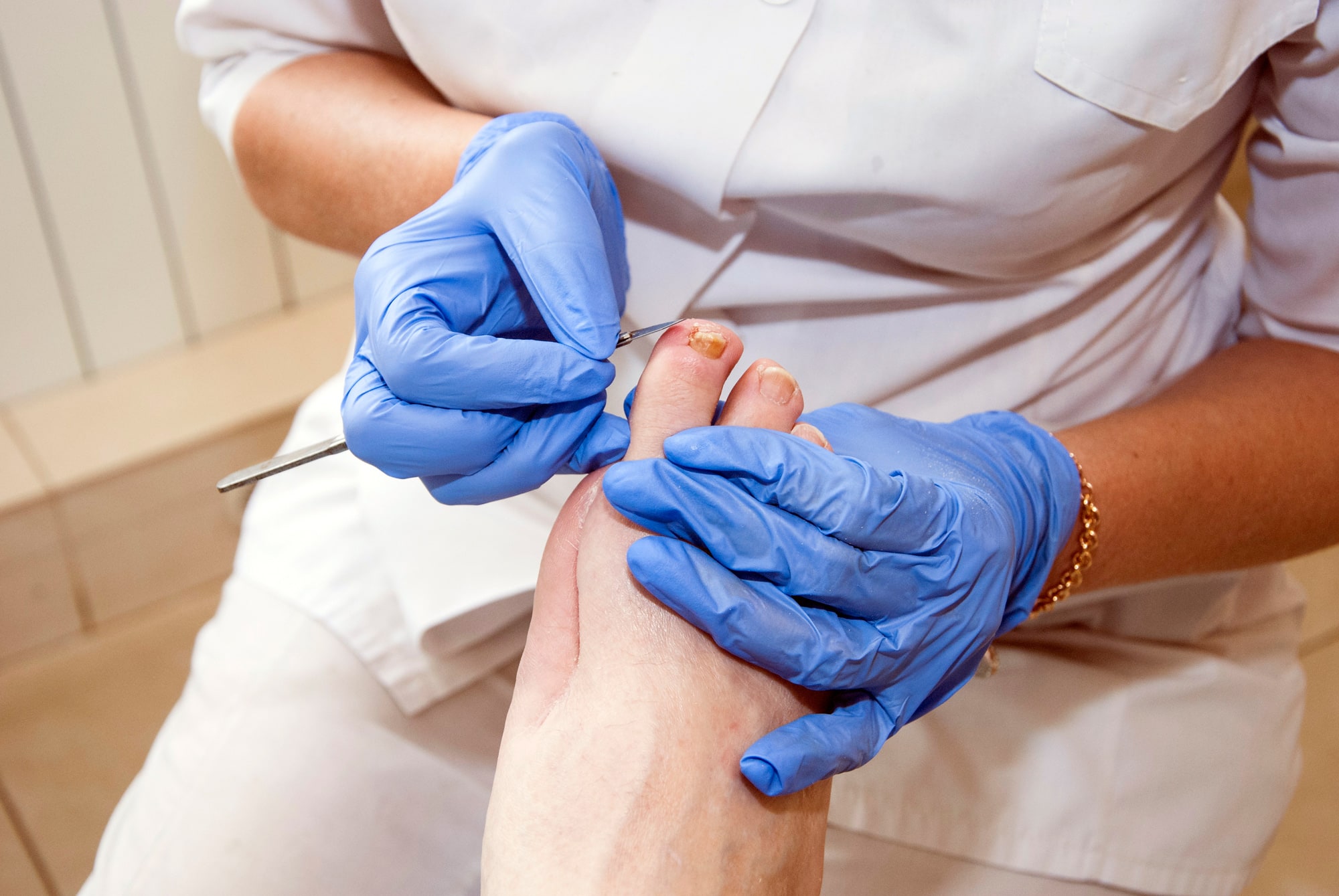 Diabetic Foot Care Advance Foot Clinic Podiatry