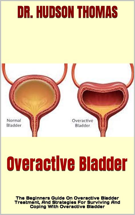 Overactive Bladder The Beginners Guide On Overactive Bladder